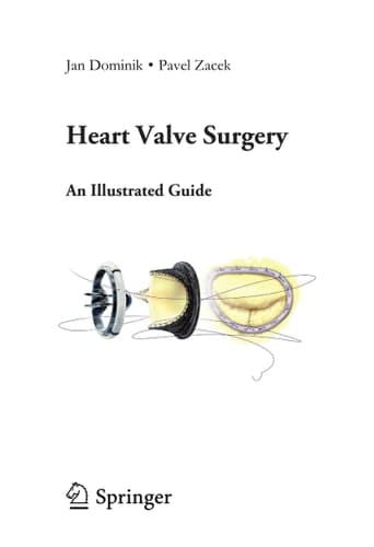 Heart Valve Surgery An Illustrated Guide