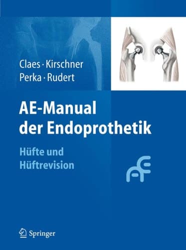 AE-Manual der Endoprothetik Hüfte und Hüftrevision