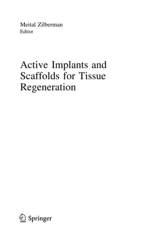 Active Implants and Scaffolds for Tissue Regeneration
