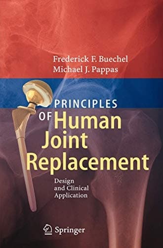 Principles of Human Joint Replacement Design and Clinical Application
