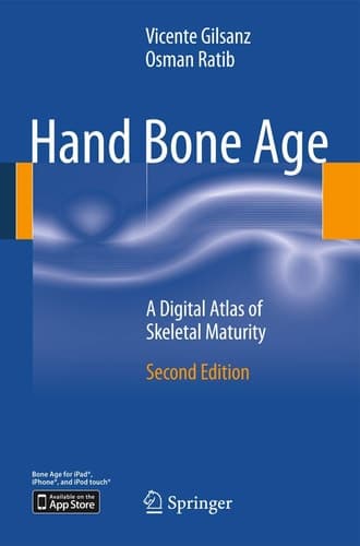 Hand Bone Age A Digital Atlas of Skeletal Maturity