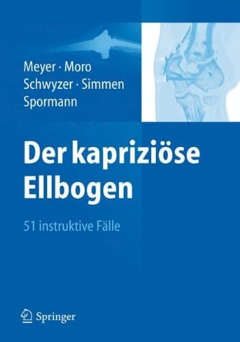 Der kapriziöse Ellbogen 51 instruktive Fälle