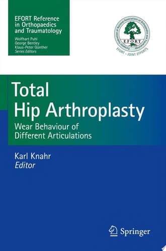 Total Hip Arthroplasty Wear Behaviour of Different Articulations