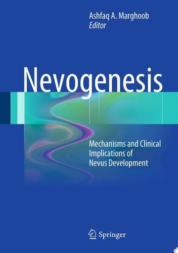 Nevogenesis Mechanisms and Clinical Implications of Nevus Development