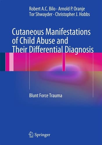 Cutaneous Manifestations of Child Abuse and Their Differential Diagnosis Blunt Force Trauma