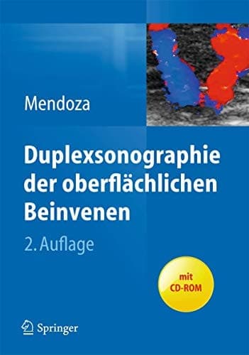 Duplexsonographie der oberflächlichen Beinvenen (German Edition)