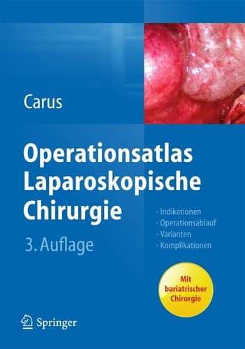 Operationsatlas Laparoskopische Chirurgie Indikationen - Operationsablauf - Varianten - Komplikationen