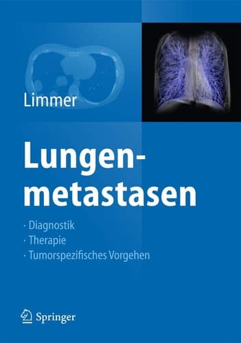 Lungenmetastasen Diagnostik - Therapie - Tumorspezifisches Vorgehen