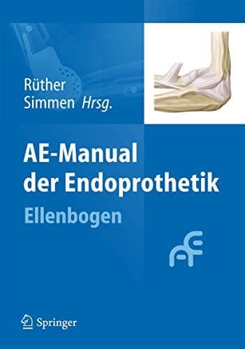 AE-Manual der Endoprothetik Ellenbogen