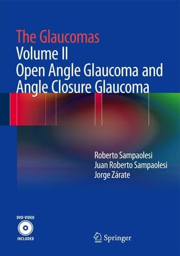 The Glaucomas: Volume II - Open Angle Glaucoma and Angle Closure Glaucoma