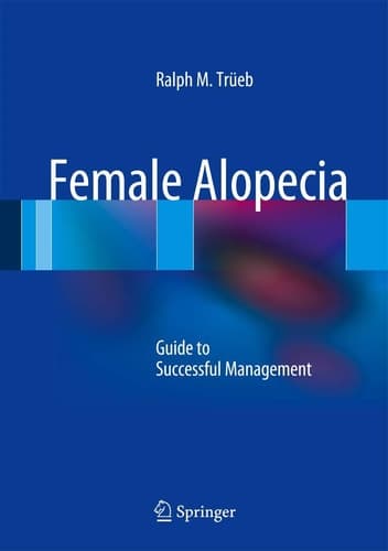 Female Alopecia Guide to Successful Management