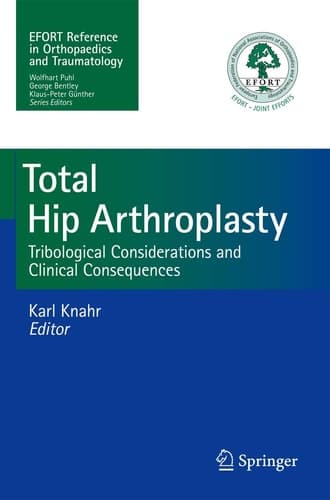 Total Hip Arthroplasty Tribological Considerations and Clinical Consequences