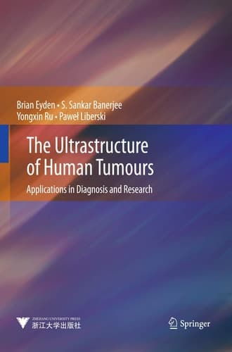 The Ultrastructure of Human Tumours Applications in Diagnosis and Research