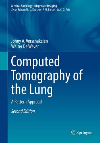 Computed Tomography of the Lung A Pattern Approach