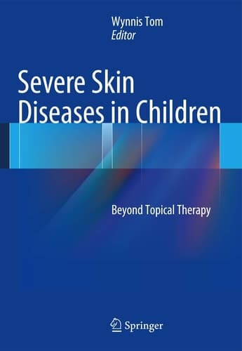 Severe Skin Diseases in Children Beyond Topical Therapy