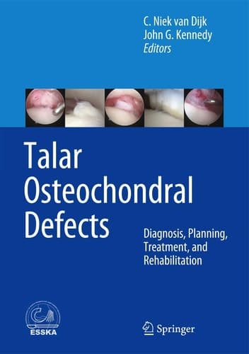 Talar Osteochondral Defects Diagnosis, Planning, Treatment, and Rehabilitation