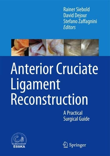 Anterior Cruciate Ligament Reconstruction A Practical Surgical Guide