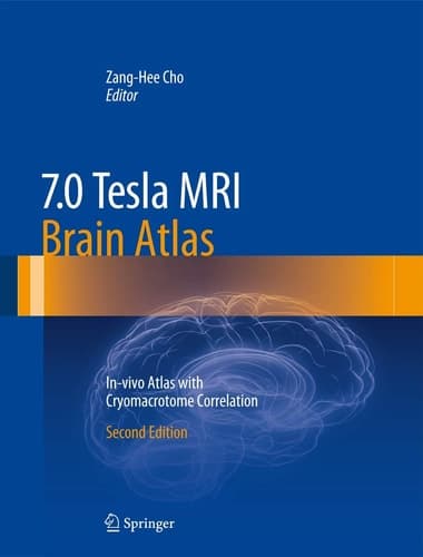 7.0 Tesla MRI Brain Atlas In-vivo Atlas with Cryomacrotome Correlation