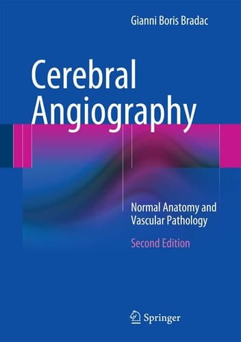 Cerebral Angiography Normal Anatomy and Vascular Pathology