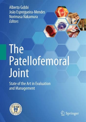 The Patellofemoral Joint State of the Art in Evaluation and Management