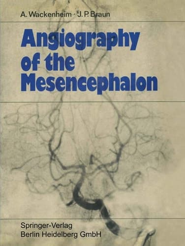 Angiography of the Mesencephalon Normal and Pathological Findings