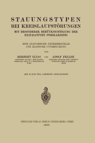 Stauungstypen bei Kreislaufstörungen Mit Besonderer Berücksichtigung der Exsudativen Perikarditis