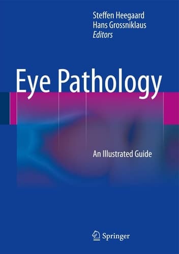 Eye Pathology An Illustrated Guide