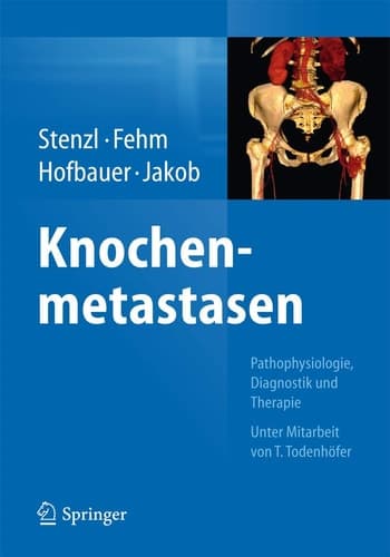 Knochenmetastasen Pathophysiologie, Diagnostik und Therapie - Unter Mitarbeit von T. Todenhöfer