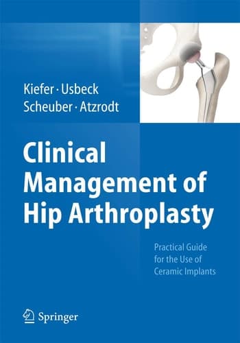 Clinical Management of Hip Arthroplasty Practical Guide for the Use of Ceramic Implants