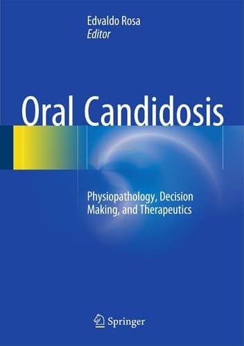 Oral Candidosis Physiopathology, Decision Making, and Therapeutics