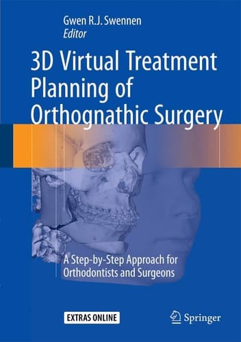 3D Virtual Treatment Planning of Orthognathic Surgery A Step-by-Step Approach for Orthodontists and Surgeons