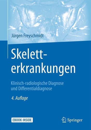 Skeletterkrankungen Klinisch-radiologische Diagnose und Differentialdiagnose