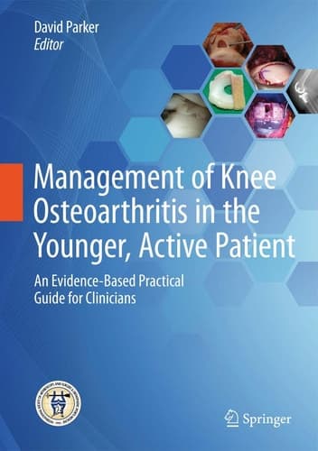Management of Knee Osteoarthritis in the Younger, Active Patient An Evidence-Based Practical Guide for Clinicians