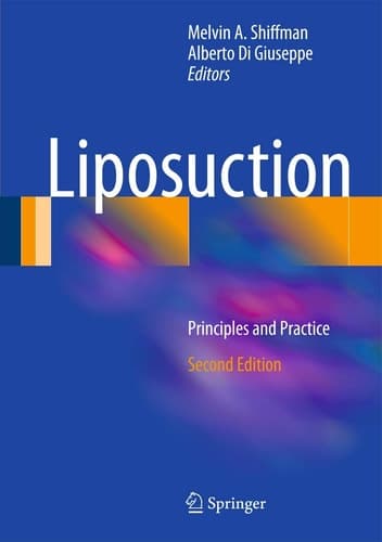 Liposuction Principles and Practice