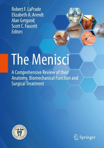 The Menisci A Comprehensive Review of their Anatomy, Biomechanical Function and Surgical Treatment