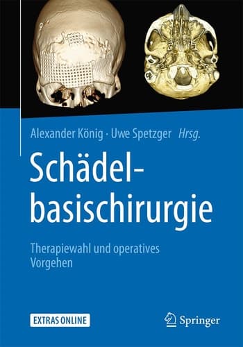 Schädelbasischirurgie Therapiewahl und operatives Vorgehen