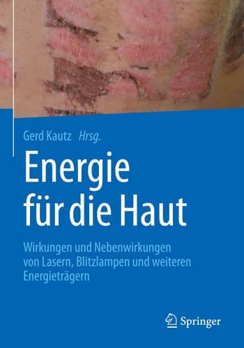 Energie für die Haut Wirkungen und Nebenwirkungen von Lasern, Blitzlampen und weiteren Energieträgern