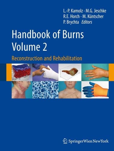 Handbook of Burns Volume 2 Reconstruction and Rehabilitation
