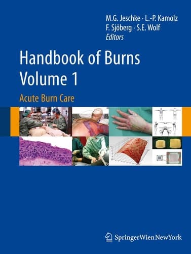 Handbook of Burns Volume 1 Acute Burn Care