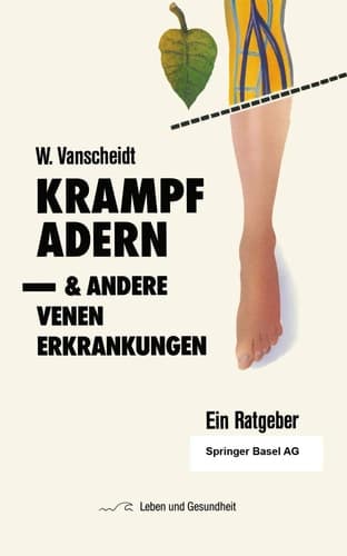 Krampfadern und andere Venenerkrankungen Ein Ratgeber