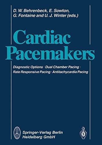 Cardiac Pacemakers Diagnostic Options · Dual Chamber Pacing Rate Responsive Pacing · Antitachycardia Pacing