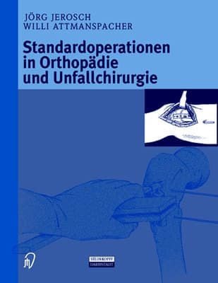 Standardoperationen in Orthopädie und Unfallchirurgie