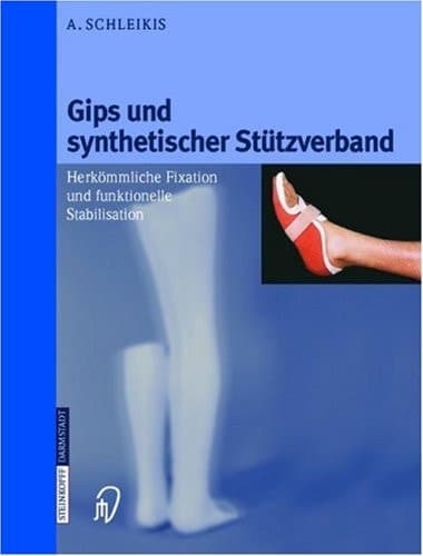 Gips und synthetischer Stützverband Herkömmliche Fixation und funktionelle Stabilisation