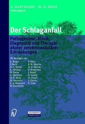 Der Schlaganfall Pathogenese, Klinik, Diagnostik und Therapie akuter zerebrovaskulärer Erkrankungen ; mit 110 Tabellen