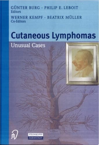 Cutaneous Lymphomas Unusual Cases
