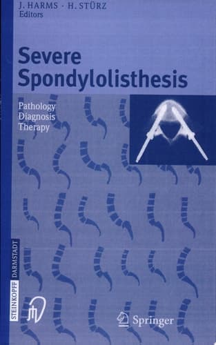Severe Spondylolisthesis Pathology, Diagnosis, Therapy