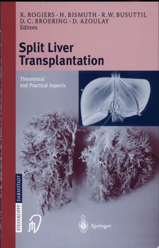 Split liver transplantation Theoretical and Practical Aspects ; 20 Tables
