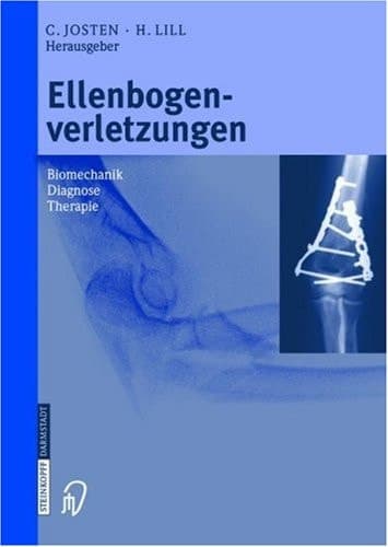 Ellenbogenverletzungen Biomechanik - Diagnose - Therapie ; mit 18 Tabellen