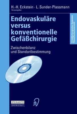 Endovaskuläre versus konventionelle Gefäßchirurgie Zwischenbilanz und Standortbestimmung