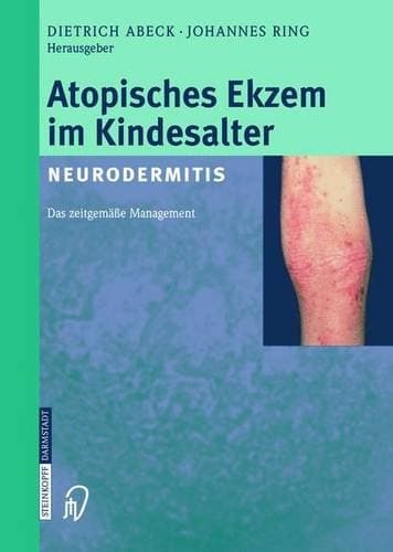 Atopisches Ekzem im Kindesalter (Neurodermitis) zeitgemäßes Management ; mit 49 Tabellen